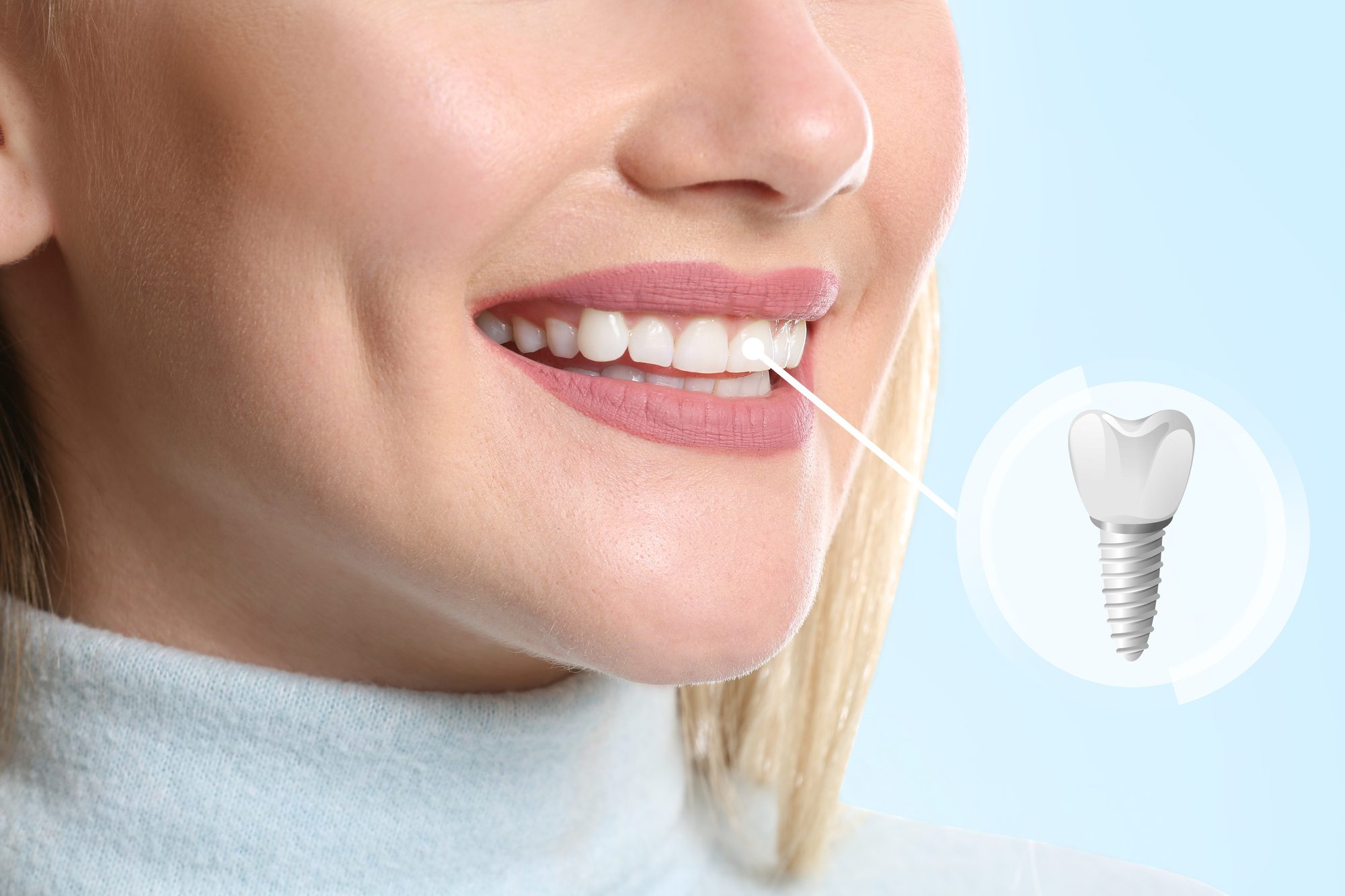 easing dental anxiety